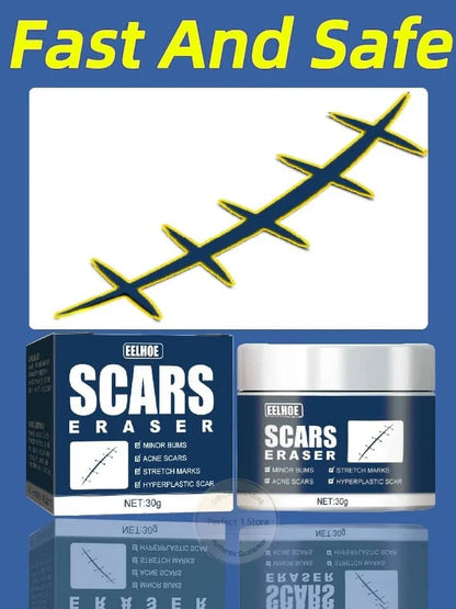 Scars, stretchmarks remover cream